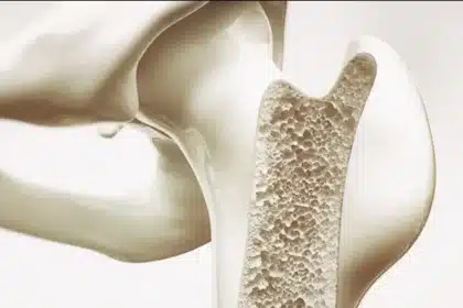 Laser Breakthrough Enables Deeper, Faster Bone Surgery Cuts