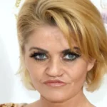 Danniella Westbrook Terrified of More Nose Surgeries After Facelift