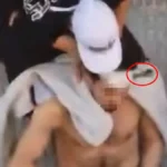 Man Survives Screwdriver Through Head in Spanish Revenge Attack