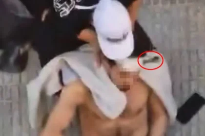 Man Survives Screwdriver Through Head in Spanish Revenge Attack